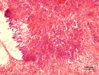 aspergilosis, lung, parrot