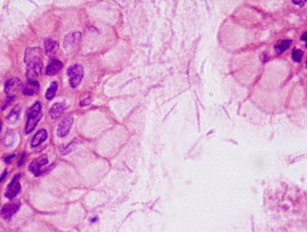 Helicobacter, stomach epithelium,dog