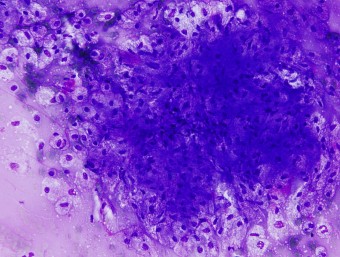 sebaceous adenoma, dog