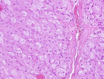 tumor of Leydign cells, rabbit