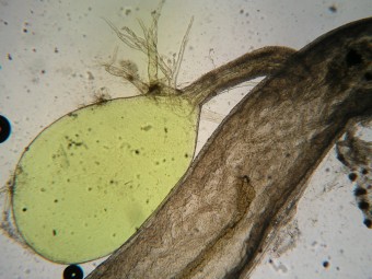 gall bladder, Toxotes