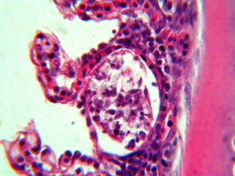 myxosporea, chub, gills